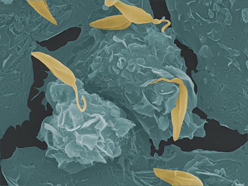 Visualisierung von Leishmanien